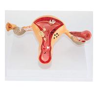 sjdoPulse Uterine Lesion Model - Female Internal And External Organs Anatomical Model - PVC Human Anatomy Science Models - for Gynecology Training Aid Medical Training Model