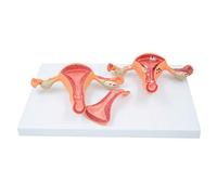 sjdoPulse Uterine Model - Human Organ Anatomy Model Uterine Contrast Model - Female Reproductive System Model Ovary Model for Gynecology Doctor Patient Communication Tool (S)