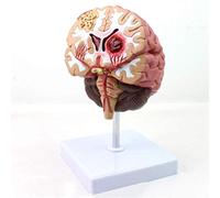 Skeleton Human Brain Anaical Model Human Brain Disease Model Brain Pathologies Brainstem Cerebral Hemorrhage for Study Display Teaching and Model A (Color : A) (A)