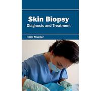 Skin Biopsy: Diagnosis and Treatment