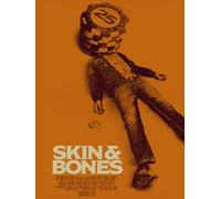 Skin & Bones
