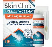 Skin Clinic Freeze 'n Clear Cryogenic Skin Label Removal Kit with 8 Precision Applicators + Tweezers Solution for Treating Frozen Skin Labels from