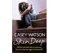 SKIN DEEP: All she wanted was a mummy, but was she too ugly to be loved?