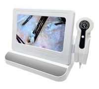 Skin Diagnosis Hair Analyzer Digital Microscope with LED Light, Portable Rechargeable Scalp Follicle Detector for Home Salon Spa, Professional Trichoscope for Hair Growth