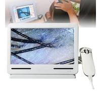 Skin Diagnosis Hair Analyzer Machine Analyser Scalp Follicle Diagnostic Microscope, Detect Problems Such as Acne, Spots, Blackheads, Etc
