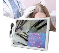 Skin Diagnosis Hair Analyzer Machine Hair Analyzer Scalp Detector with 70x/200x Lenses Magnification for Scalp and Hair Follicle Inspection, Oil and Moisture Detection, Professional Skin Dia