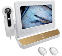 Skin Diagnosis Hair Analyzer, Skin Scalp Detector, Supports Freeze Frame Image, Hair Follicle Detector, Oil Content Tester For Hair Loss/Moisture/Flexibility/Oil Content