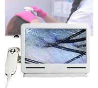 Skin Hair Detector Diagnosis Analyzer Machine Scalp Follicle Oil Moisture Magnifying Tester, Improve Scalp Condition, for Detection and Detection, High-Definition Camera