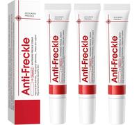 Skin Lightening Cream, Whitening Freckle Removal Cream, Dark Spot Remover For Face, Moisturizing Removes Facial Melasma Dark Spots Wrinkles Blemishes, Improve Skin Dullness (3PC)