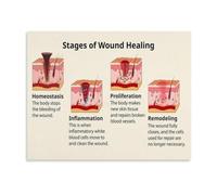 Skin Repair Phases Poster Wound Healing Process Chart