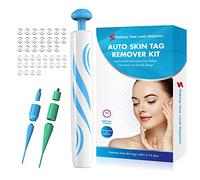 Skin Tag Removal Kit, Safe Skin Tag Remover Pen with 40 Skin Tag Bands Verruca Remover Painless& Easy Remover Wart and Mole(2-8mm) (Style 2)
