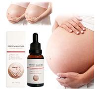 Skin Tag Removal Stretch Mark Cleansing Oil Skin Scar Smoothing Moisturizing Oil Smooth Skin Stretch Mark Solution 30ml All Kinds Shower Products Holiday Essentials