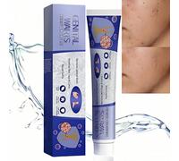 Skin Tag Remover Cream,Fast Acting Mole Removal Cream,Mole & Wart-Remover Cre/am,Skin Wart Remover for Skin and Face,Painless Wart Rem/Over,Wipe Off Sk/in Tags for Face, Hands Body & Face,Safe