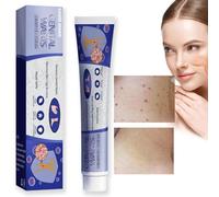 Skin Tag Remover Cream,Skin Wart Remover for Skin and Face,Skin Wart Treatment,Tags and Mole Remover Cream for Body,Natural Wart Remover Cream for Hands and Foot,Fast-Acting Tag Remover Skin1