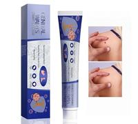 Skin Tag Remover Cream, Tags and Mole Remover Cream for Body, Skin Wart Remover, Wart Skin Tag Remover, Removing Moles Creams, Verruca Treatment, Wart Remover for Hands, Verruca Remover