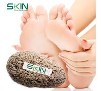 Skinapeel Large Pumice Stone - Natural Foot Care Scruber - Dead Hard Skin Callus Remover - Pedicure Tool - Skinapeel UK Skincare Specialists