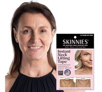 Skinnies Instant Neck Lift - 15 Pair - MADE IN USA - Patented Lift & Tuck Design for a Tight, Youthful Neck - Discreet & Undetectable Under Hair