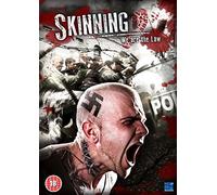 Skinning - We Are The Law [DVD]