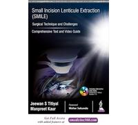Small Incision Lenticule Extraction (SMILE): Surgical Technique and Challenges: Comprehensive Text and Video Guide