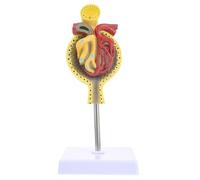SMASOLO Human Glomerulus Anatomical Model Medical Teaching Model with Base for Accurate Anatomy Education and Student Learning Aid
