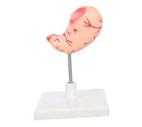 SMASOLO Realistic Gastric Structure for Biology Education Easy Assembly Disassembly for Teaching Stomach Functions and Pathologies