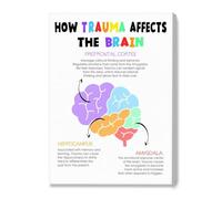 SMGLRUEAT The Stress Response Poster, Nervous System Chart, Psychology Classroom Decor, Science Teaching Aid for High School or College (Framed,16x24inch(40x60cm))