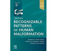 Smith's Recognizable Patterns of Human Malformation: Expert Consult - Online and Print