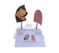 Smoker Lung and Anatomical Model for Teaching PVC Substance Clinical Classroom Demonstration Participatory Education Set
