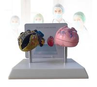 Smokers Heart Model & Healthy Heart Model with Pathological Features and Accurate Anatomy Structure for Emonstrate The Effects of Smoking on Heart Health