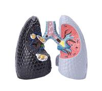 Smokers Lung Model + Healthy Lung Model, Human Anatomy, Pathological Features and Accurate Anatomy Structure for The Effects Of Smoking On Lung Health
