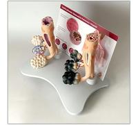 Smoker'S Lung Model With Healthy Anatomy, Realistic Pathological Features For Educational Purposes On Effects Of Smoking And Lung Health, Anatomical Study Aid