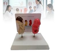 Smoking Baby Comparison Model, Healthy vs Pathology Fetus Comparison Anatomy Model with Display Stand Pregnancy Health Education Aid for Medical School Clinic