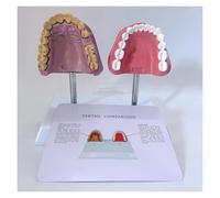 Smoking Teeth and Healthy Teeth Comparative Model, Human Oral System Teeth Anatomy Model, Standard Teeth Model for Dental Students, Clean Display
