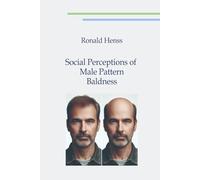 Social Perceptions of Male Pattern Baldness