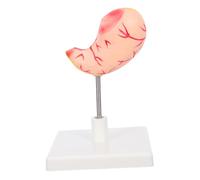 SOIMISS Anatomical Stomach Model for Classroom and Realistic Educational Tool for Medical Schools and Research Institutions
