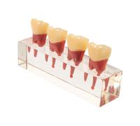 SOLUSTRE Pediatric Model with Interactive Removable Teeth and Resin Material for Disease Teaching and Hands-on Practice in Schools, Realistic Oral Anatomy Demonstration of Primary Teeth
