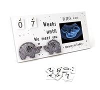 Sonogram Picture Frame Ultrasound Picture Frames for 4"x 3" Ultrasound Photo, Baby Sonogram Photo Album, Ultrasound Frame for Expectant Moms (White)