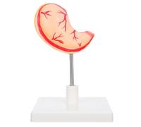 Sosoport Human Stomach Anatomy Model: Stomach Model For Education - Anatomy Teaching Tool For Science Classrooms And Clinical Trainings