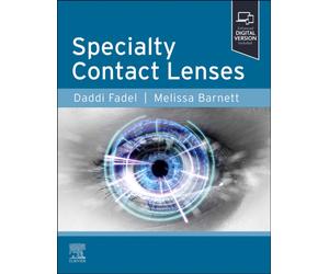 Specialty Contact Lenses