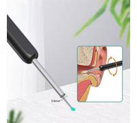 SPETLEK Wireless HD Ear Wax Removal Camera Endoscope Spoon Pick Cleaning Kit in White