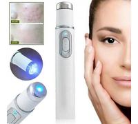 Spider Vein Eraser Blue Light Removal Eraser erapy Wrinkle Acne Laser Pen Scar