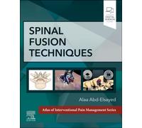 Spinal Fusion Techniques