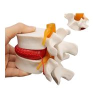 Spine Lumbar Disc Herniation Model Human Anatomy Teaching Tool Brain Trauma Medical Demonstration Instrument