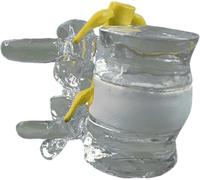 Spine Model, Human Lumbar Disc Compression Demonstration Model, Widely Applicable To Orthopaedics, Surgery, For Clinical Teaching