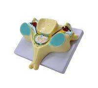Spine Model of Enlarged 5th Cervical Vertebra Teaching Aid Fifth Cervical Spine with Medulla Spinalis for Study Spinal Cord Transection