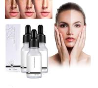 Spot Remover Serum,Dark Spot Remover,Smooth the Skin Face Serum,Freckle Removing Essence,Dark Spot Corrector for Face and Body (3 Pcs)