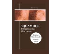 SQUAMOUS CELL CARCINOMA SKIN CANCER: The Illustrated Guide: Types, Diagnosis, Treatment, Prevention, Resources, Management And Question to ask your doctor