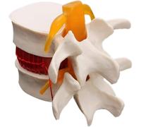 SSDDLZEQ Human anatomical model White Spine Lumbar Disc Herniation Teaching Model Brain Cranial Trauma School Supplies Medical Equipment Anatomical Human Spine Model