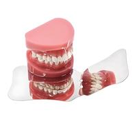 Stainless Stee Dental Photography Mirror Oral Reflector for Orthodontic Use Professional Teeth Examination Tool(A)