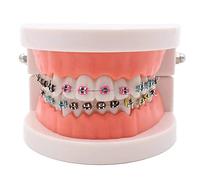 Standard Dental Teeth Model, Child Teeth Teaching,Dental Orthodontic Demonstration Model with Metal Bracket for Teaching, Studying, Displaying, Patient Communication